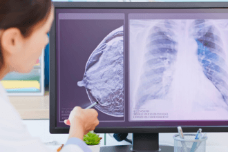 Vinicius Tadeu Sattin Rodrigues explica como o monitoramento contínuo pode fortalecer a estratégia preventiva contra o câncer de mama.