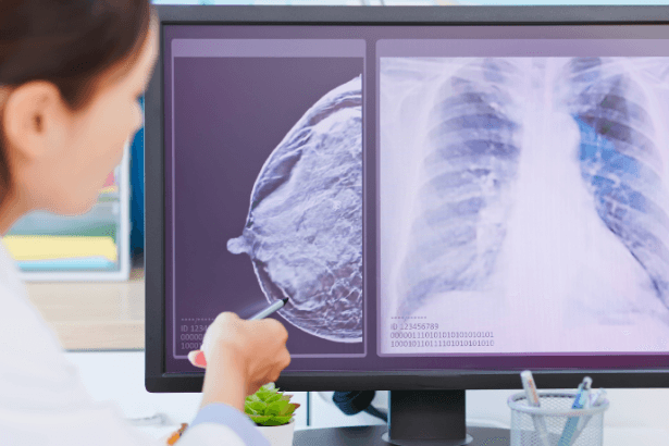 Vinicius Tadeu Sattin Rodrigues explica como o monitoramento contínuo pode fortalecer a estratégia preventiva contra o câncer de mama.